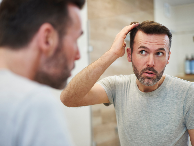 Man worried creatine causes hair loss