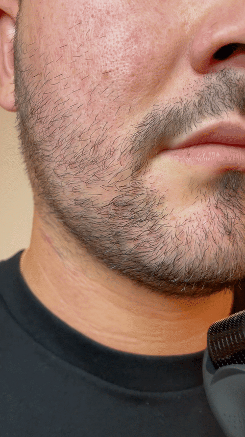 My Beard Kit®