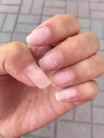 Remove Artificial Nails Roughly