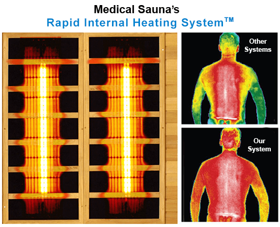 Medical saunas body heating illustration