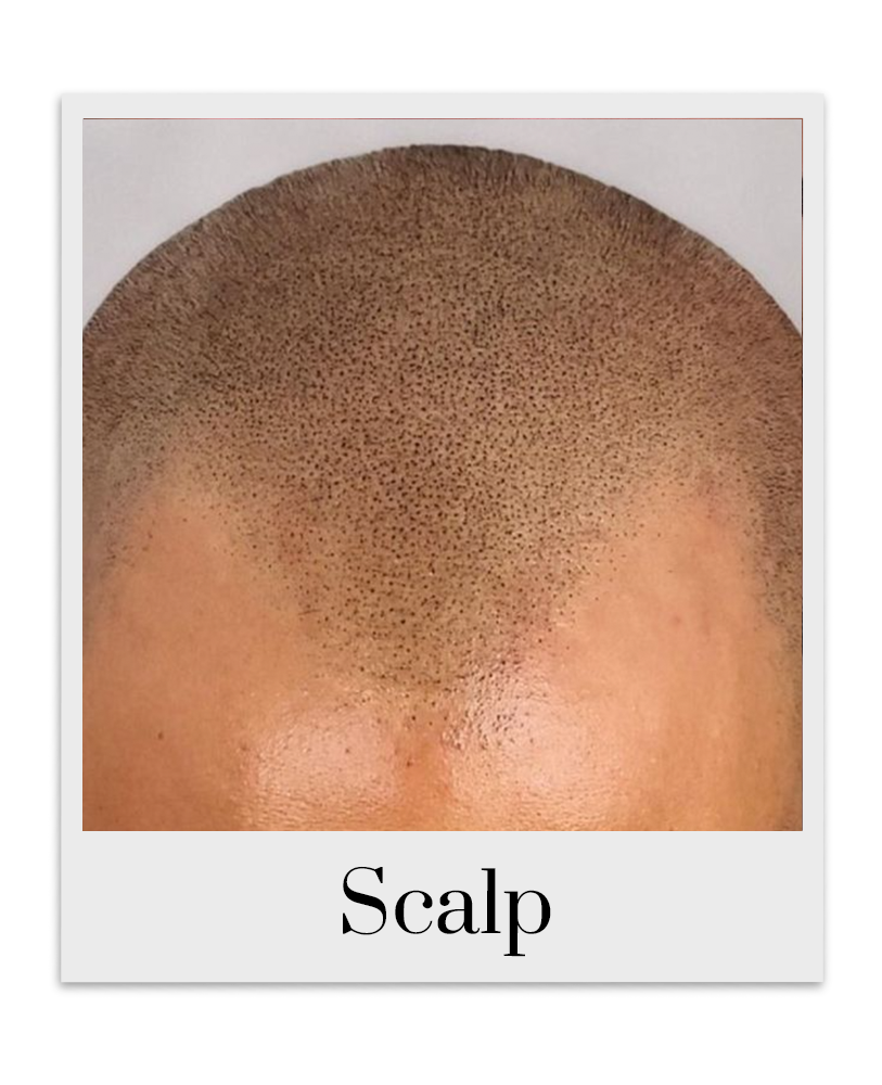 Scalp Pigments