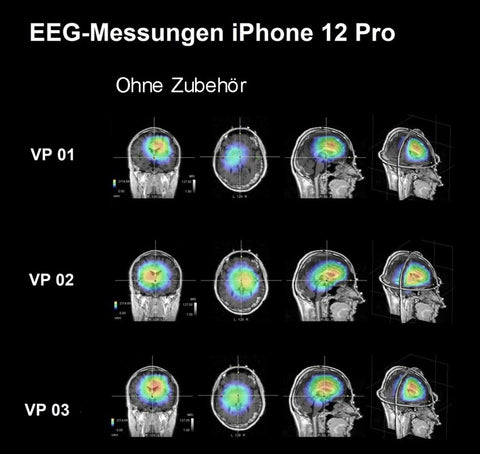 EEG Ohne Zubehör