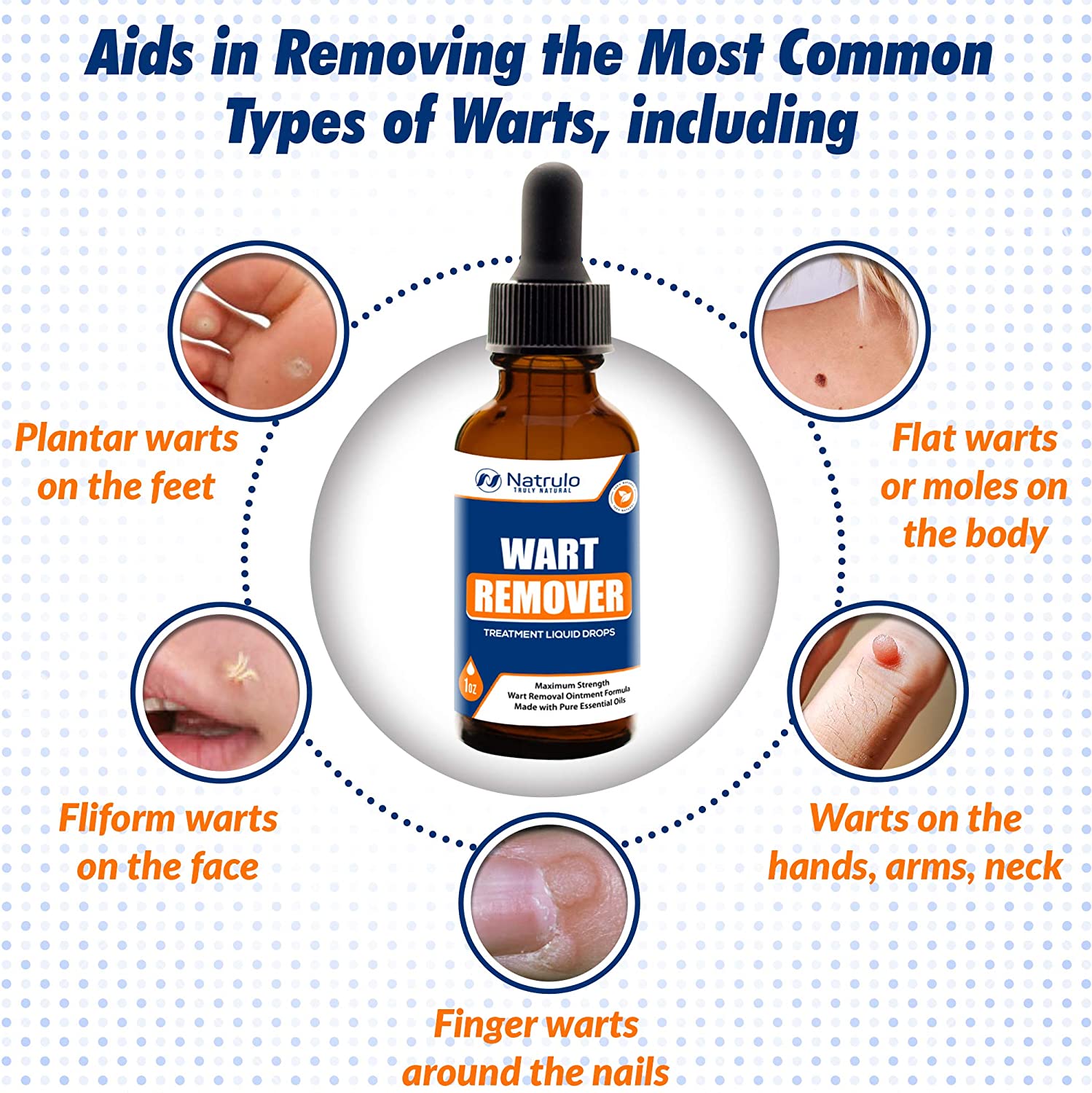 Types Of Warts On Face | ces-cl.edu.br