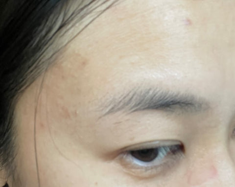 damaged skin barrier