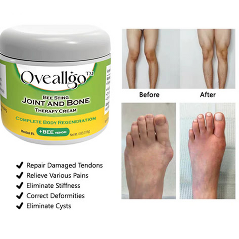 Oveallgo™ Apitoxin-derived Substance Body Pain Relief Cream