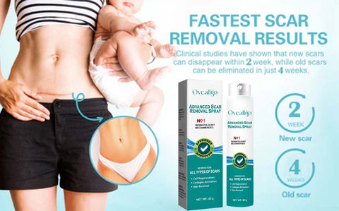 Oveallgo™ Advanced Scar Removal Spray
