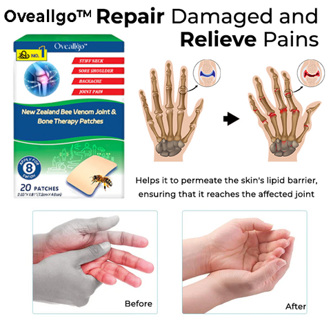 Oveallgo™ New Zealand Bee Venom Joint & Bone Therapy Patches