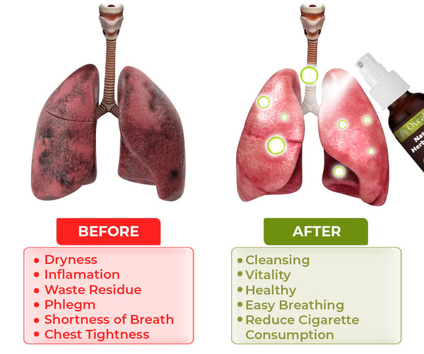 LungGuard™ BreatheWellnatuurlijke kruidenspray voor long-en ademhalingsondersteuning