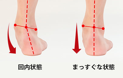 後足部の安定と距骨の回内を抑制