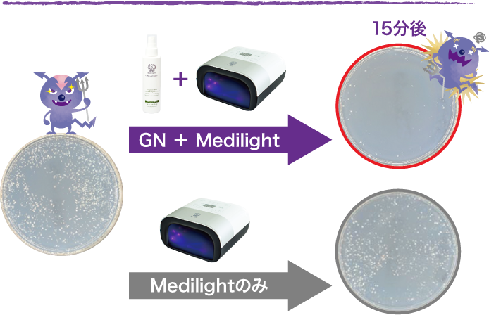 GN+Medilightで緑膿菌の数が激減