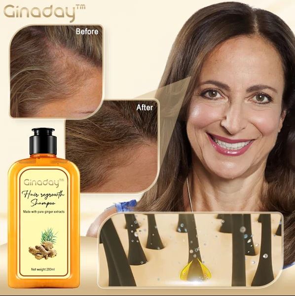 Ginaday™ Instant Ginger Hair Regrowth Shampoo Thedealzninja 