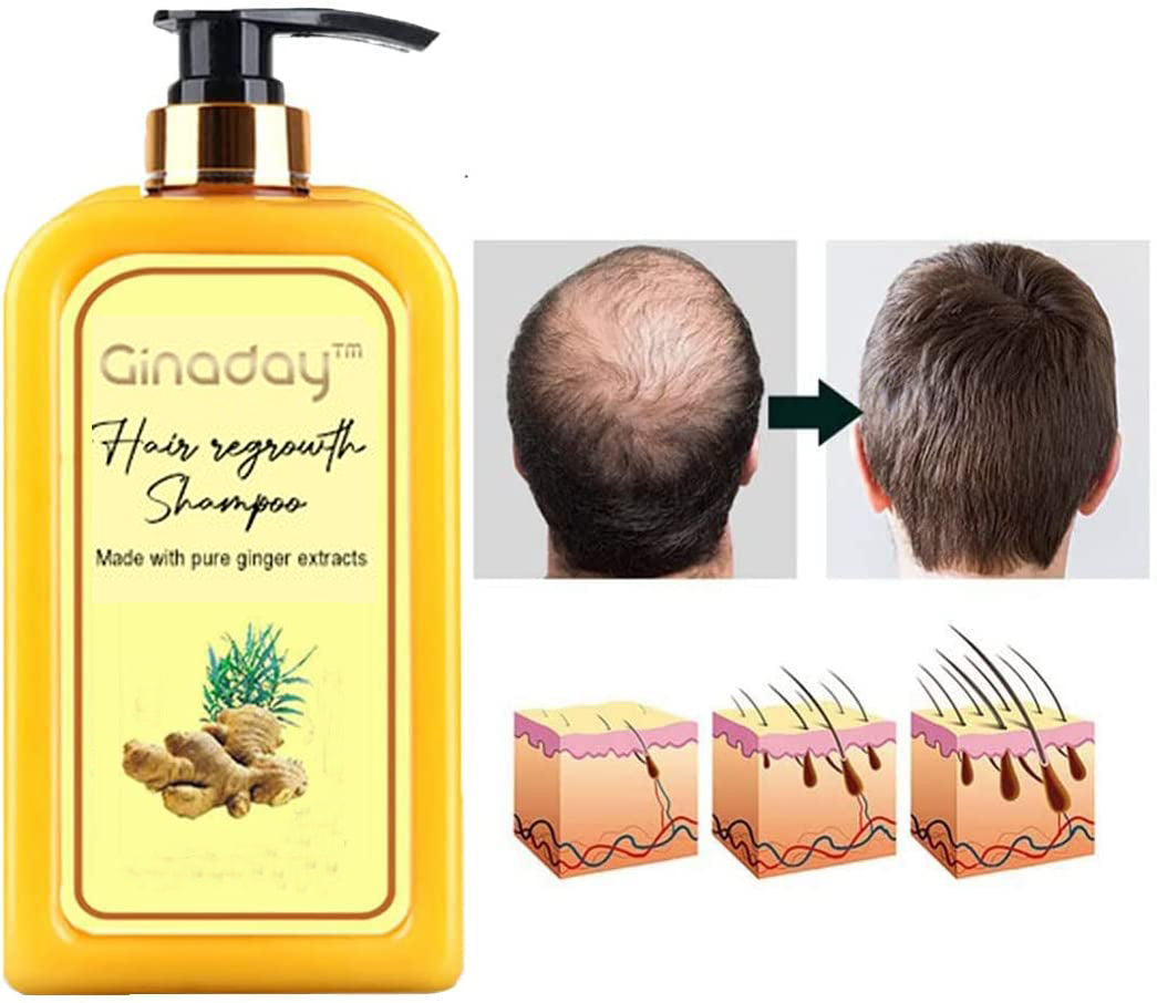 Ginaday™ Instant Ginger Hair Regrowth Shampoo Thedealzninja 