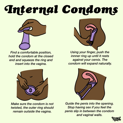 internal condom diagram
