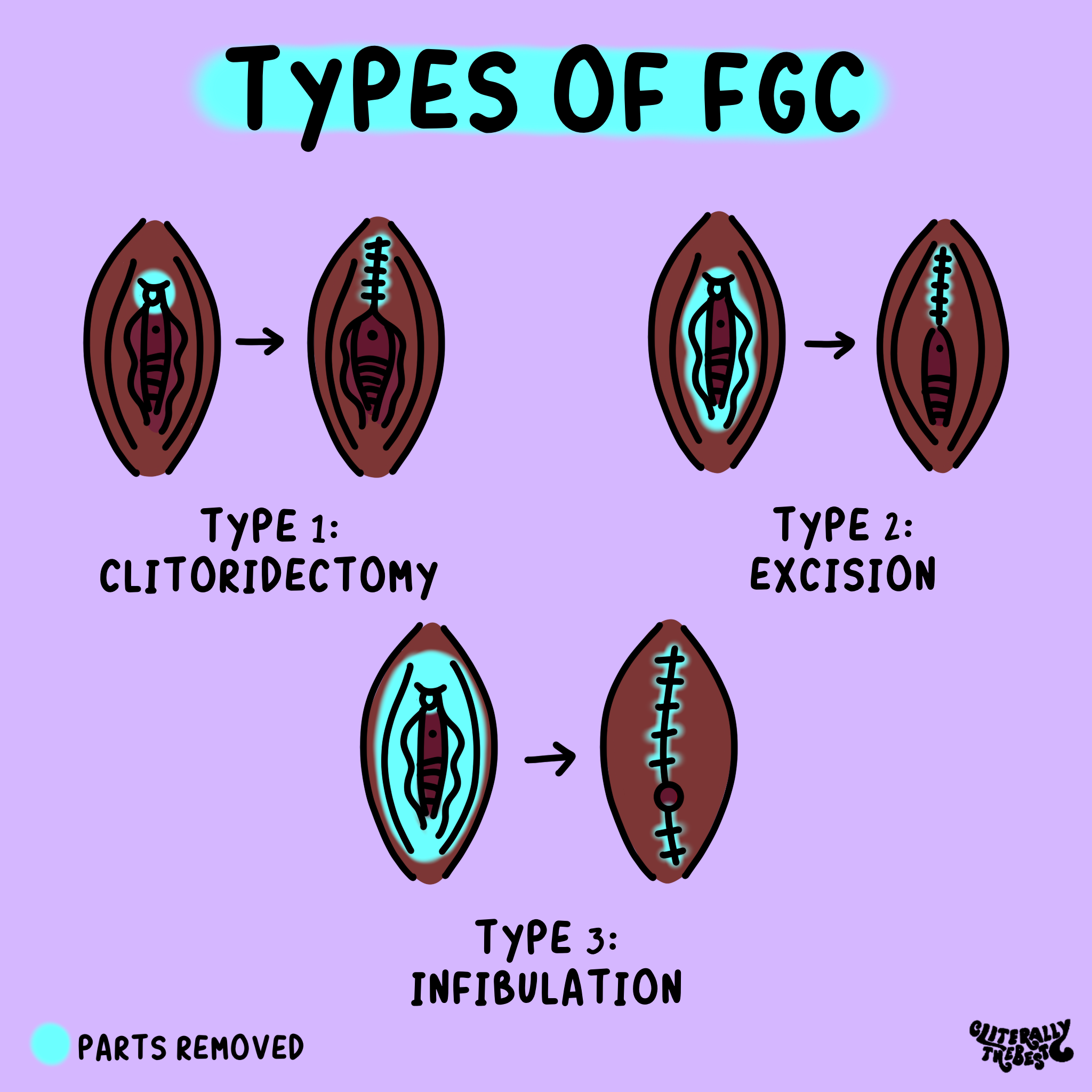 fgm fgc diagram cliterally the best