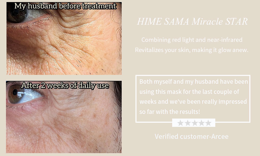 Verified customer-Arcee review for HIME SAMA Miracle STAR: "Both myself and my husband have been using this mask for the last couple of weeks and we've been really impressed so far with the results!"