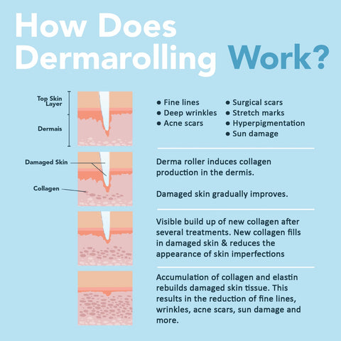 Infographic on how does dermarolling work with a derma roller