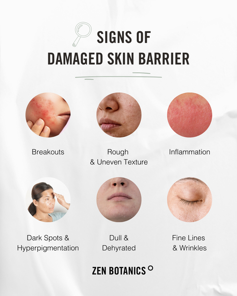 Signs of a damaged skin barrier infographic