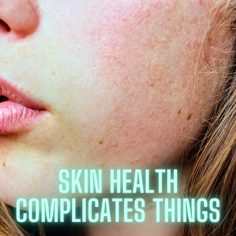 Dry skin, acne, scars, and other skin health issues can change the appearance of your natural undertones