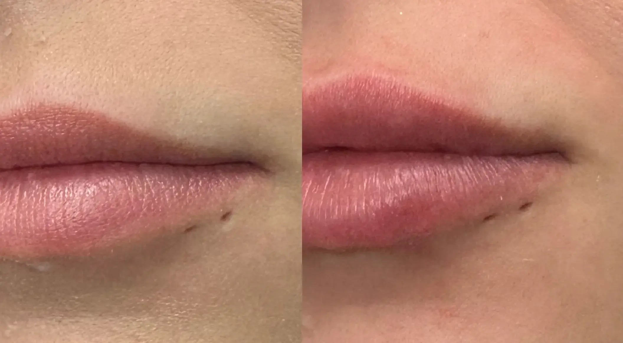 Lip_3_1