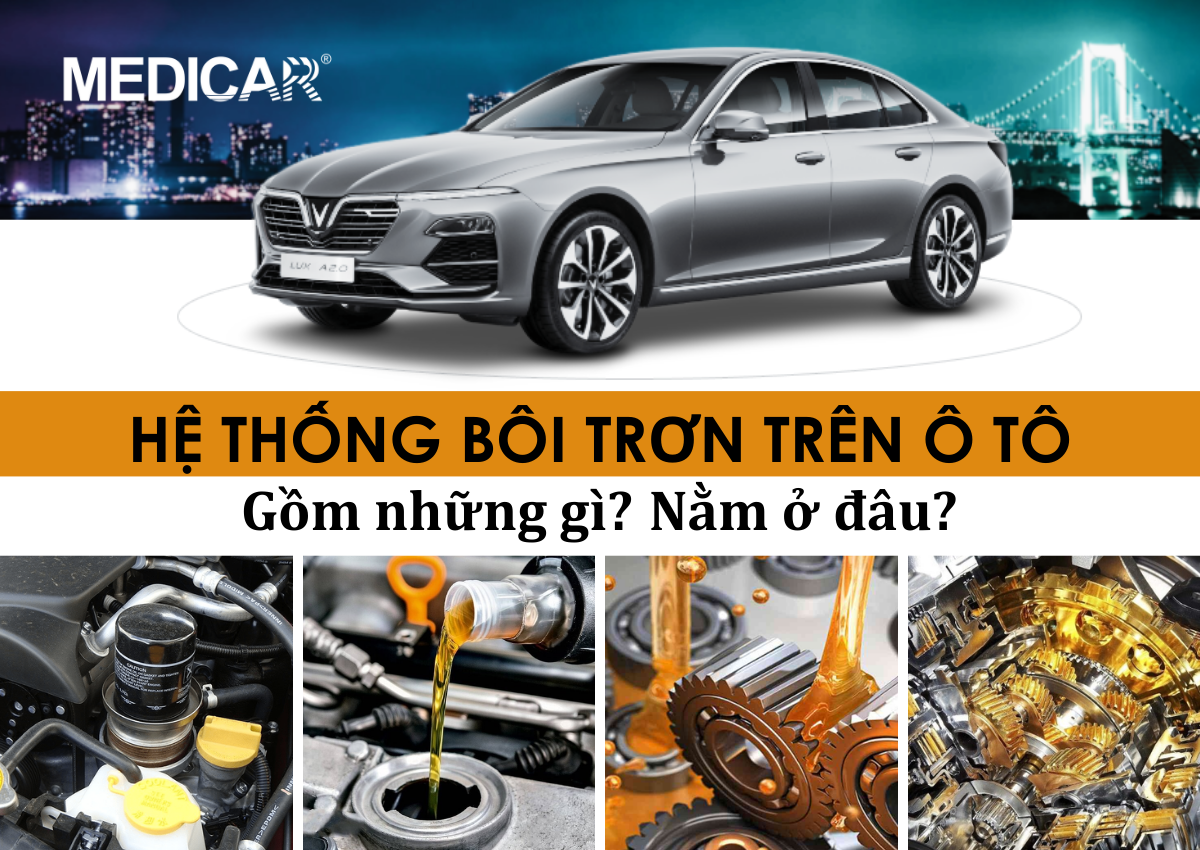 Hệ thống bôi trơn trên ô tô gồm những gì