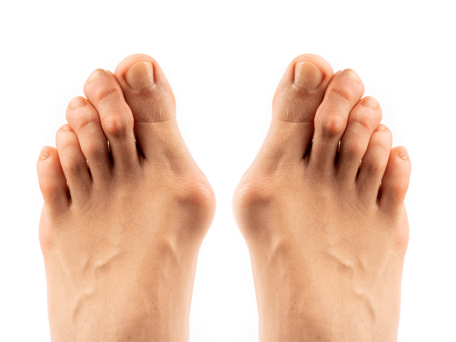 India's leading Foot Health & Podiatry Experts – Curafoot