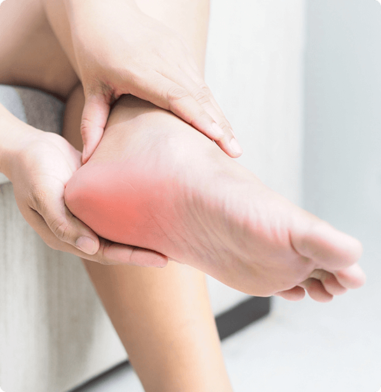 Disease/Condition: Overpronation: What It Is, Causes & Treatment