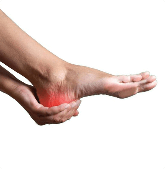 Symptoms of a Heel Spur