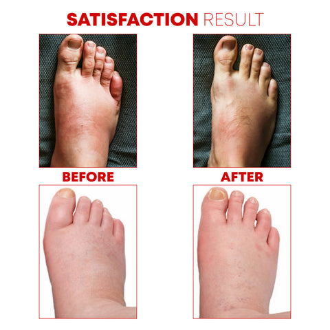 DetoxCARE LymphaticDrain FootPatch