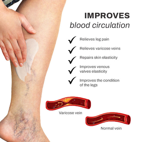 LymphCare VaricoseVeins Treatment Cream