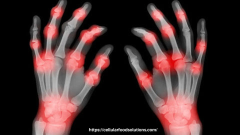Different Types of Arthritis and the need to follow Advanced Arthritis Relief Protocol
