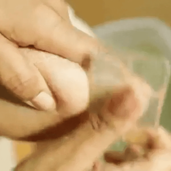 Hands removing a bandage from a wound on a foot.