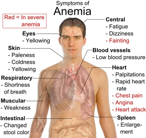 Microcytic Anaemia (Iron Deficiency)