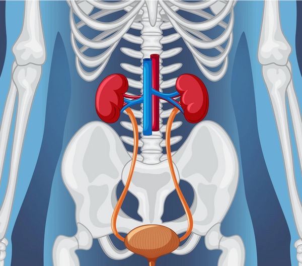 Kidney Failure