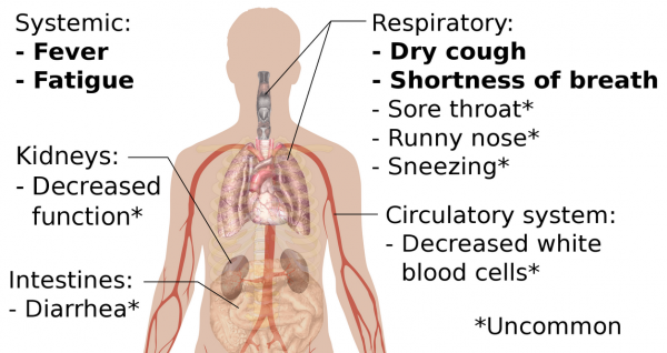 How to Maintain Strong Immune System to Combat Coronavirus