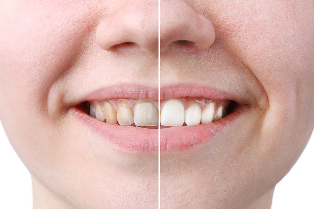 Woman's healthy teeth and smile