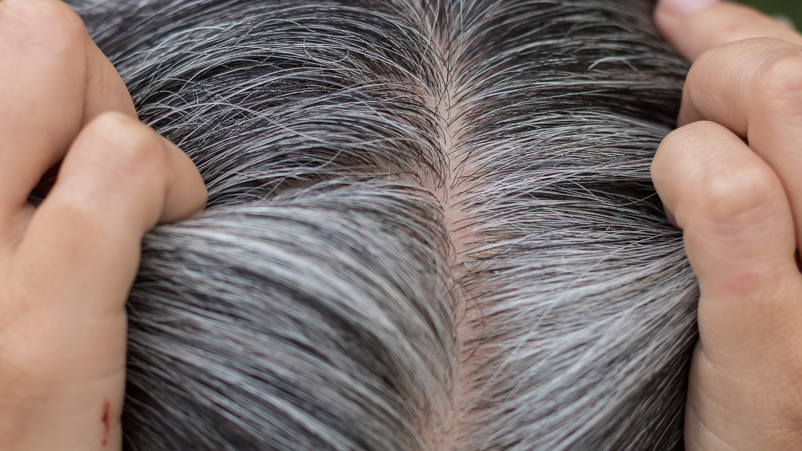 How To Reverse Grey Hair Naturally  The Man Company