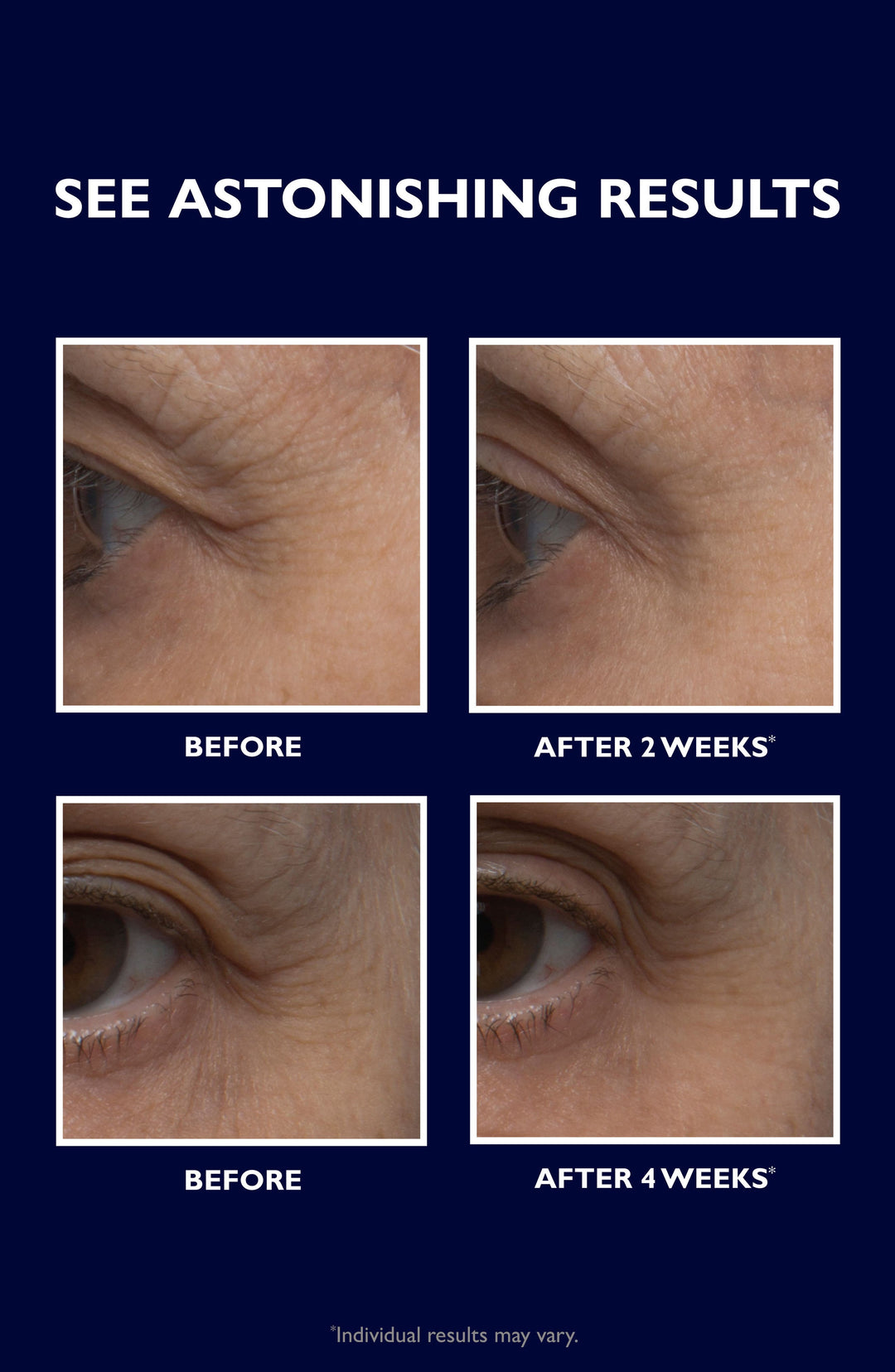 Peter Thomas Roth Retinol Fusion Eye Cream 0.5 oz – Masters Beauty Store