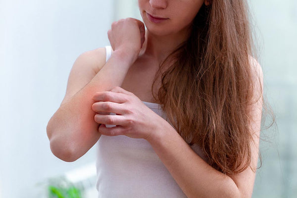 woman itching her psoriasis on arm