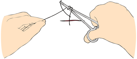 Desenho de porta-agulha prestes a realizar o primeiro seminó da sutura