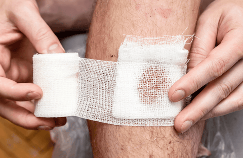 Imagem de uma perna com uma ferida sendo coberta por curativo