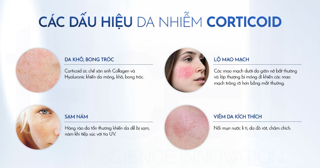 Phục hồi da nhiễm corticoid do kem trộn