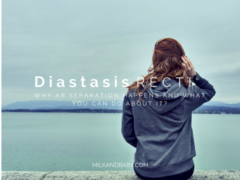 diastasis recti