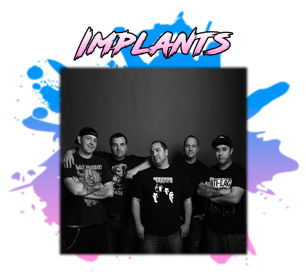 Implants