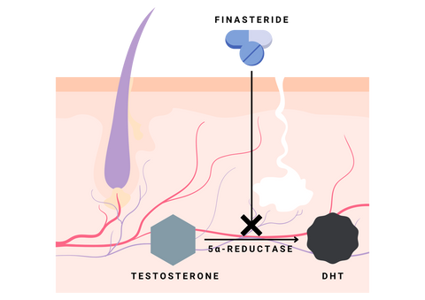 Schematic of finasteride mechanism