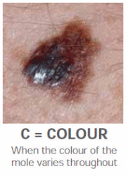 SkinCancer Colour