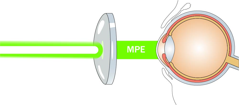 Maximum Permissible Exposure ("MPE")