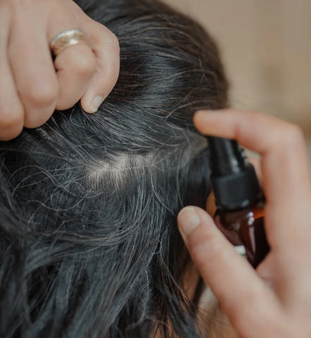 Scalp Spray for Psoriasis Relief