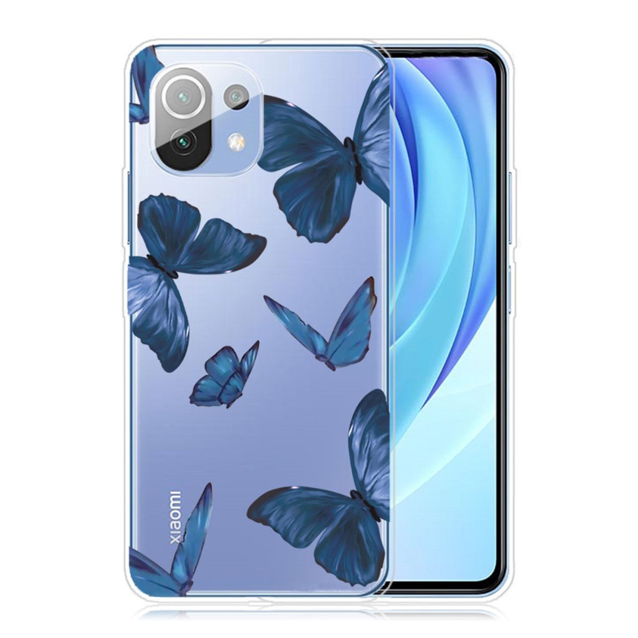 Deco Xiaomi Mi 11 case - Blue Butterfly