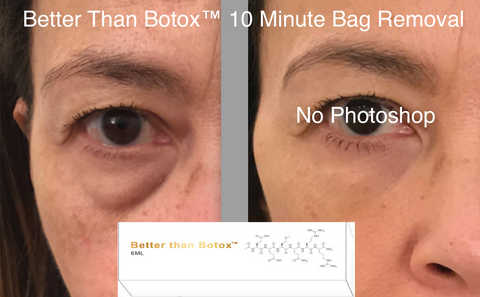 Under Eye Bags fix in 10 minutes The Quantum Facial "Professional Edition" is the next generation of our massively popular flagship eye serum , Better Than Botox