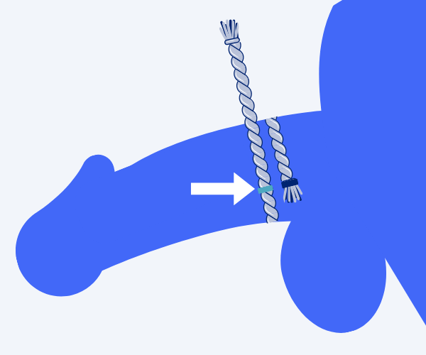 Cock Ring Sizing Illustration